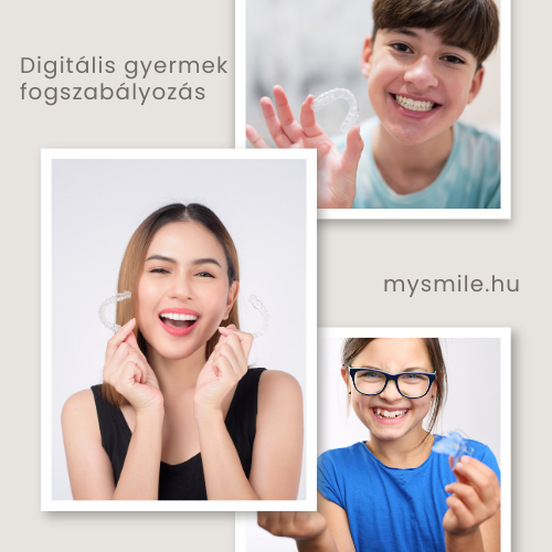 Digitális fogszabályozás - gyerek fogszabályozás