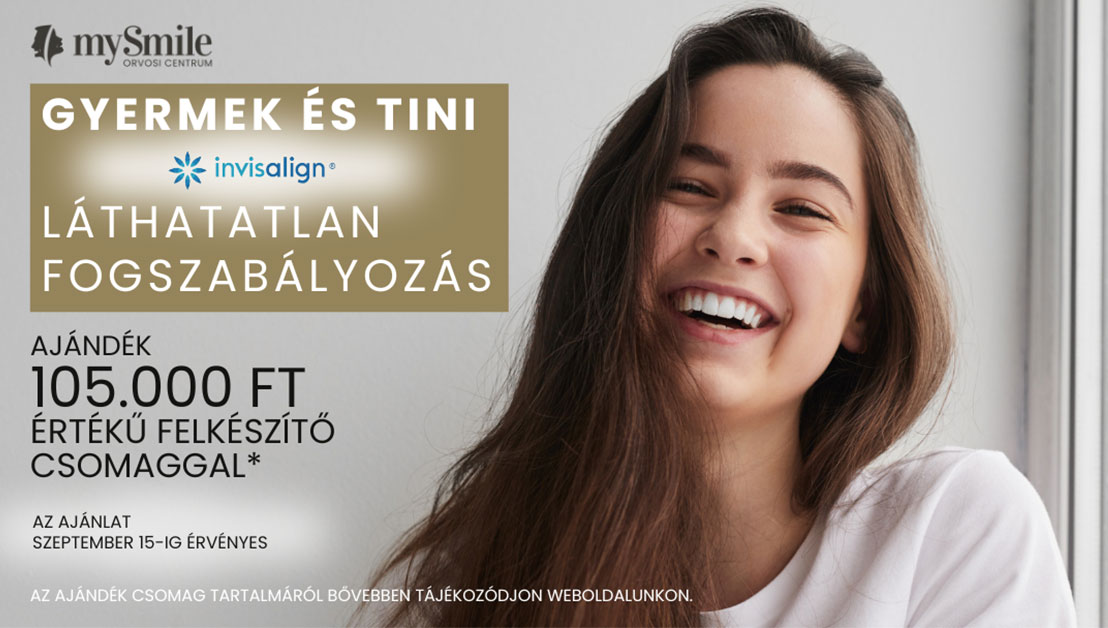 mySmile aktuális ajánlat