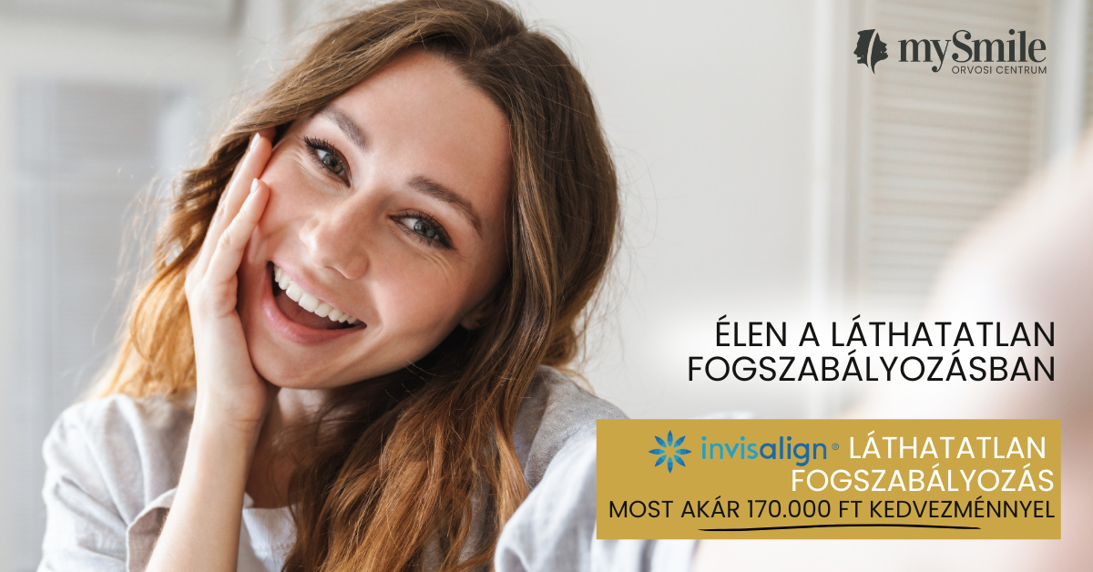 invisalign 2.png (864 KB)