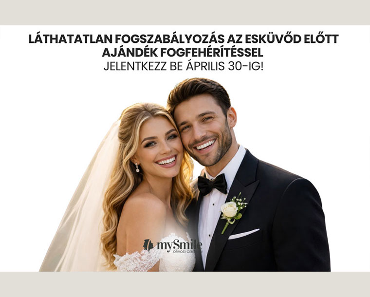 konzultacioajandekkal.jpg (60 KB)